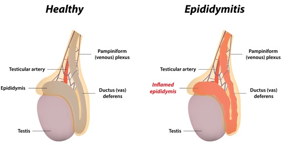 Testicular-Function-Problems-and-Treatments-epididymis